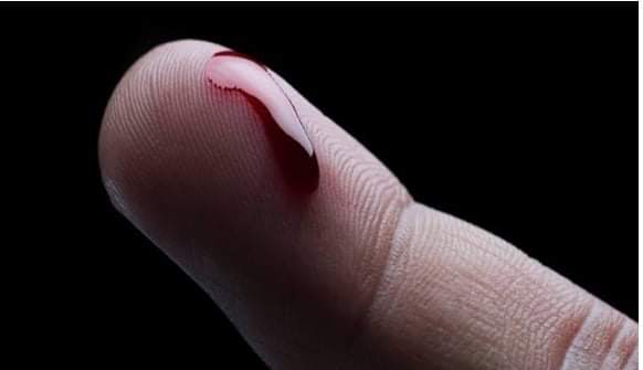 জেনে নিন রক্তকোষে লৌহসমৃদ্ধ প্রোটিন হিমোগ্লোবিন বাড়ানোর উপায়: