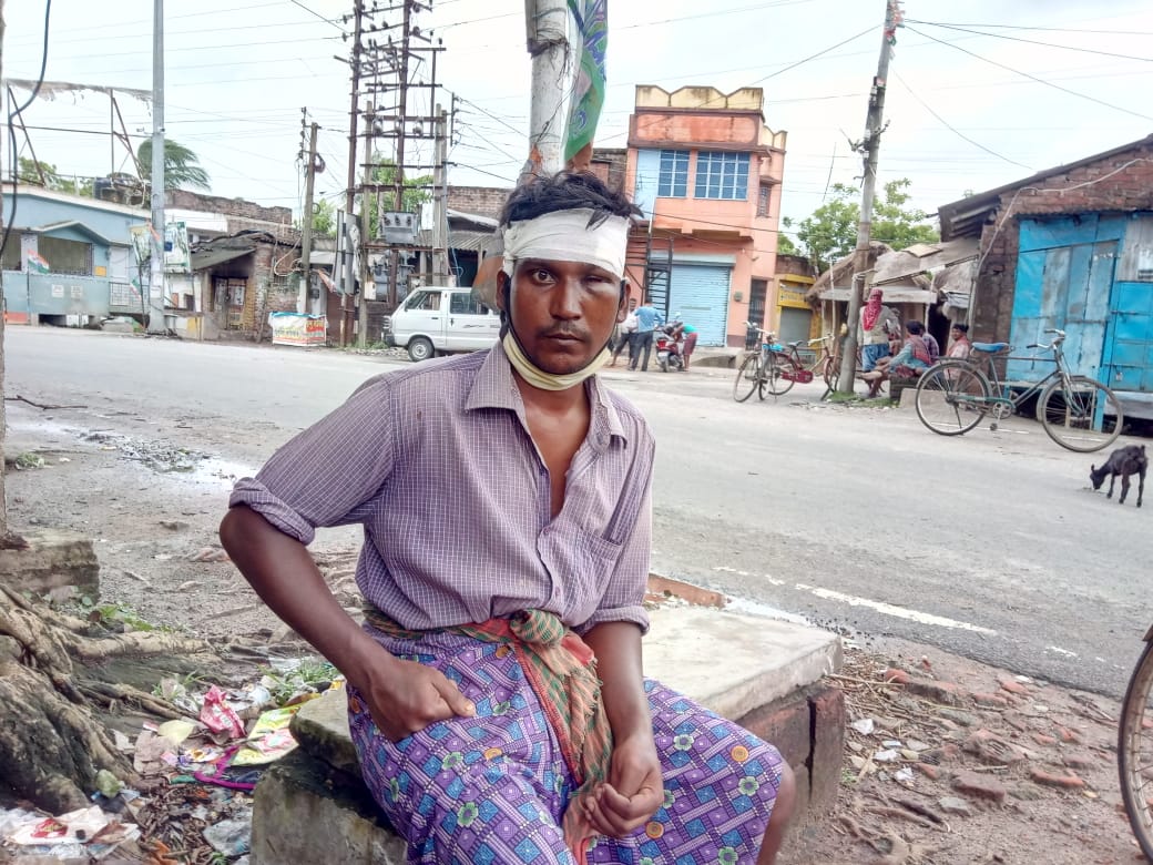 লকডাউনের দিন কটূক্তির প্রতিবাদ করায় আক্রান্ত, গুরুতর আহত হয়ে বর্ধমান হাসপাতালে ভর্তি