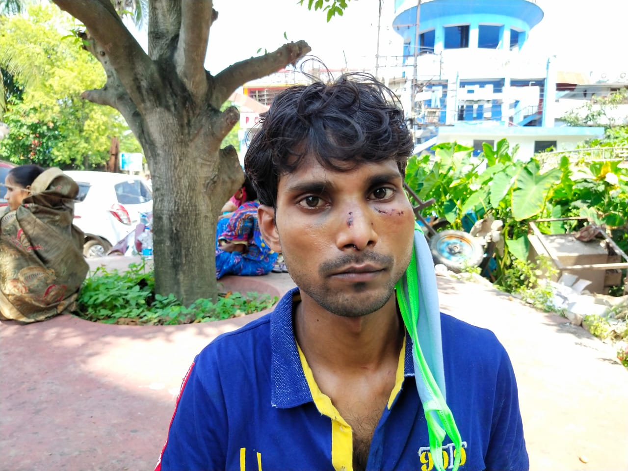 মদ্যপ অবস্থায় মারধর ও গভীর রাতে হামলা টোটো চালককে বাড়িতে