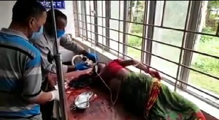 বেয়াইয়ের ধারালো অস্ত্রের আঘাতে গুরুতর আহত বেয়াইন