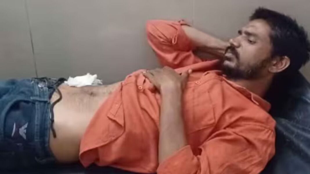 উত্তরপ্রদেশের যুবক ইউটিউব দেখে নিজ হাতে পেটে অস্ত্রোপচারের চেষ্টা, পেট কাটার পর করলেন ১১টা সেলাইও! তারপর যা পরিণতি হল