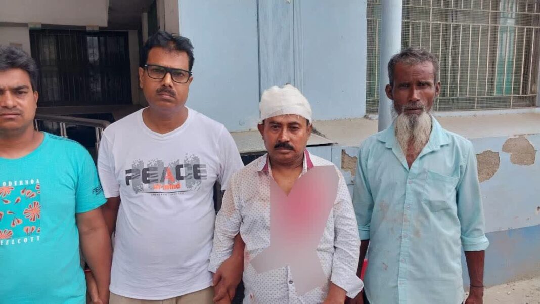 মালদা মেডিক্যাল কলেজে ছাদের চাঙড় ভেঙে গুরুতর আহত হন এক ব্যক্তি, নিম্নমানের রক্ষণাবেক্ষণের অভিযোগে উঠলো হাসপাতাল কর্তৃপক্ষের ওপর!