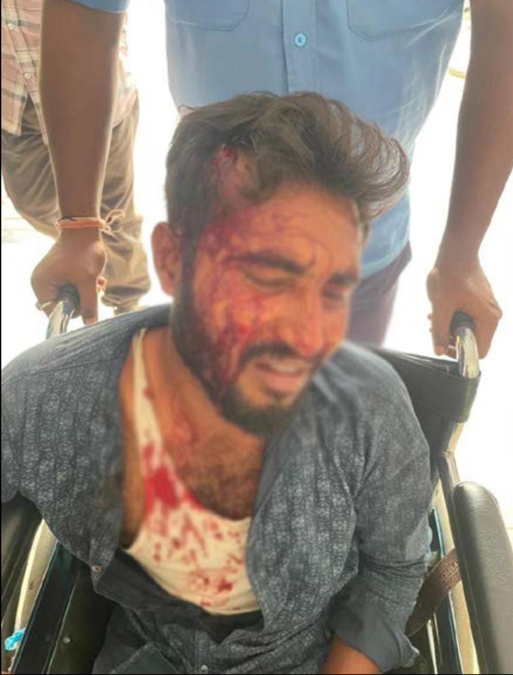 ভিনরাজ্যে বাংলা বলায় খেতে হলো মার, ওড়িশায় আক্রান্ত পূর্ব মেদিনীপুরের পরিযায়ী শ্রমিক