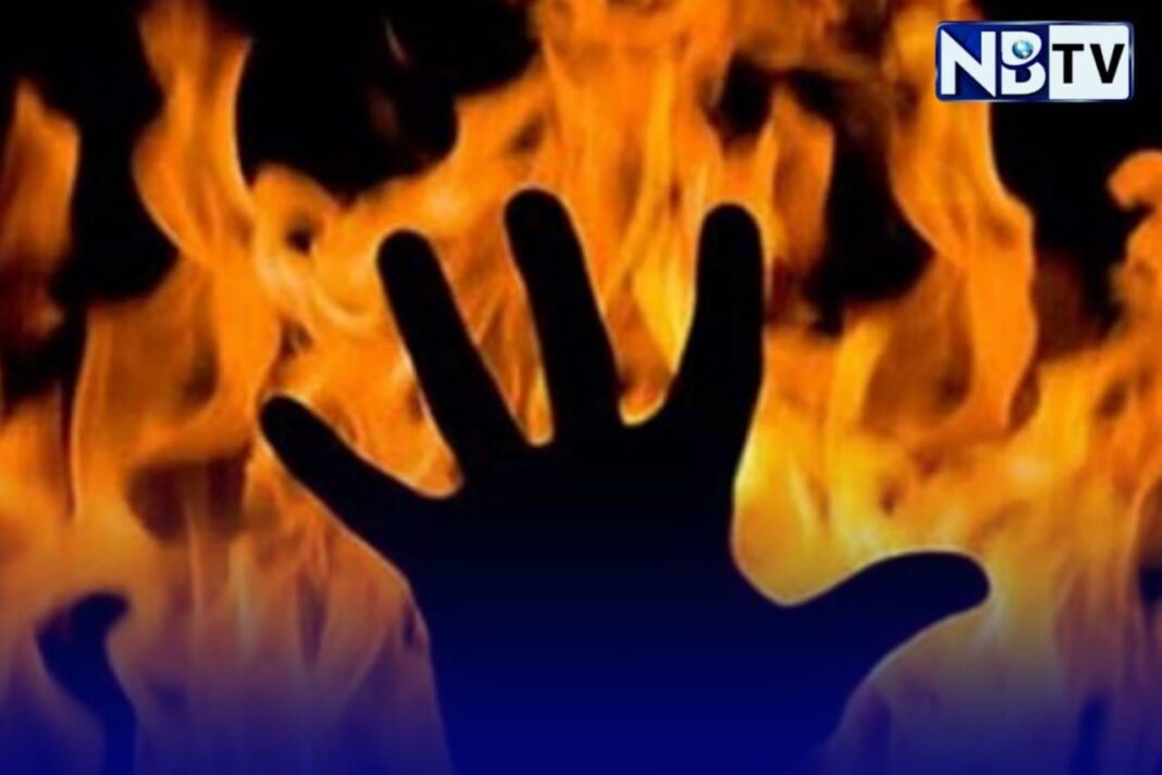 উত্তরপ্রদেশে এক কলেজের সামনে ১৯ বছরের মুসলিম পড়ুয়ার গায়ে আগুন লাগিয়ে দেওয়ার অভিযোগ
