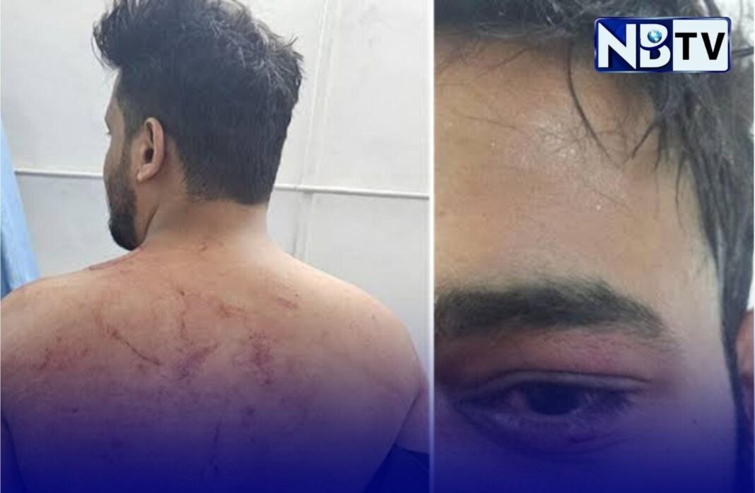 ইফতারের সময় হামলা! মুসলিমদের ‘টুপি খুলতে’ হুমকি, জখম অন্তত ১১ জন