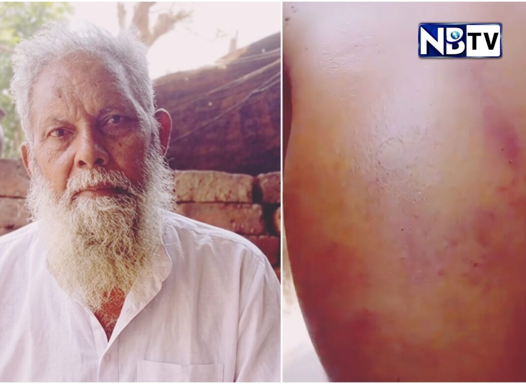 উত্তরপ্রদেশে প্রবীণ মুসলিম ফেরিওয়ালার উপর হামলা, মারধর ও লুটের অভিযোগ!
