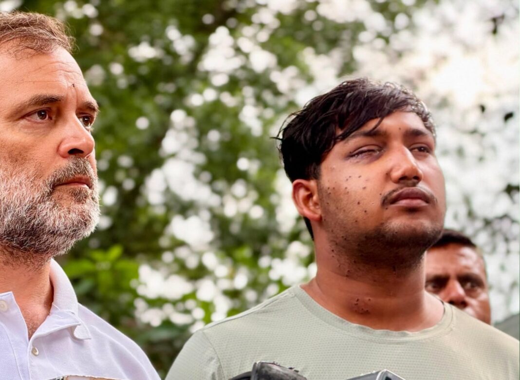 দিল্লির ‘সংসদ চলো’ মিছিলে পেলেট ব্যবহারের অভিযোগ,দৃষ্টিশক্তি হারানোর আশঙ্কায় ১৯ বছরের ছাত্র